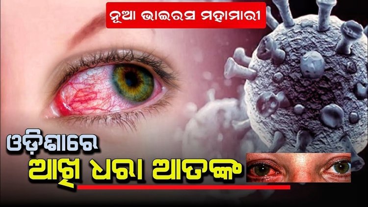 ରାଜ୍ୟରେ ବ୍ୟାପୁଛି ଆଖିଧରା ରୋଗ