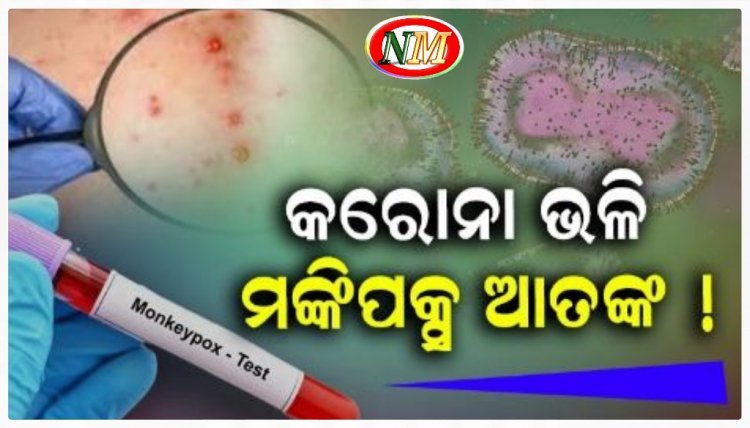 ଭାରତରେ ମଙ୍କିପକ୍ସ ସନ୍ଦିଗ୍ଧ ଆକ୍ରାନ୍ତ ଚିହ୍ନଟ, ସବୁ ପ୍ରବେଶ ପଥରେ ଆଲର୍ଟ